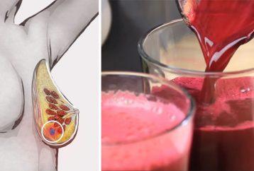 This Juice Prevents Cancer, Cleanses Your Liver & Lowers High Blood Pressure!
