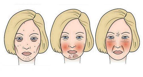 4 մթերք, որոնք փչացնում են Ձեր դեմքը 