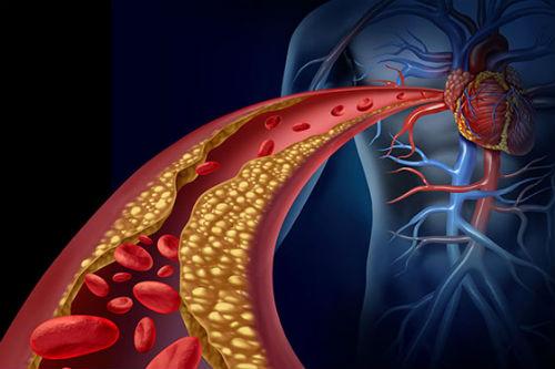 Проверенное средство для очищения артерий и понижения холестерина