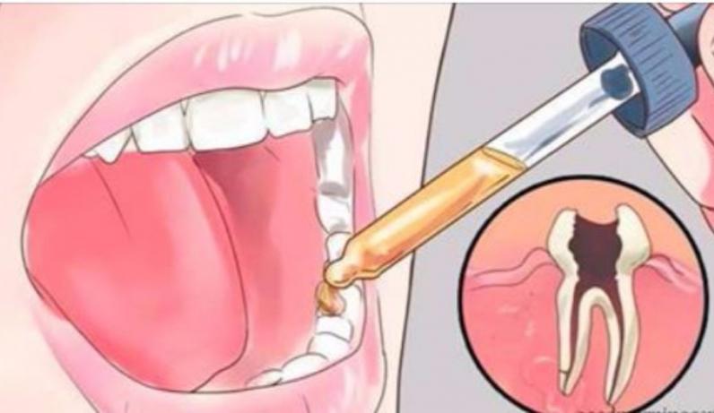 Вот как снять ЛЮБУЮ зубную боль за 5 секунд