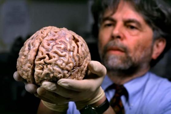 10 անհավանական փաստեր մարդու ուղեղի մասին, որոնք գլխիվայր շուռ կտան ձեր բոլոր պատկերացումները