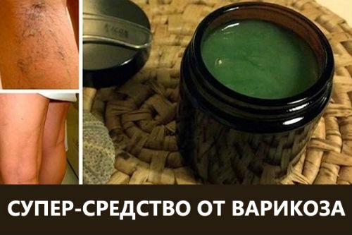 Чудесное средство от варикозного расширения вен