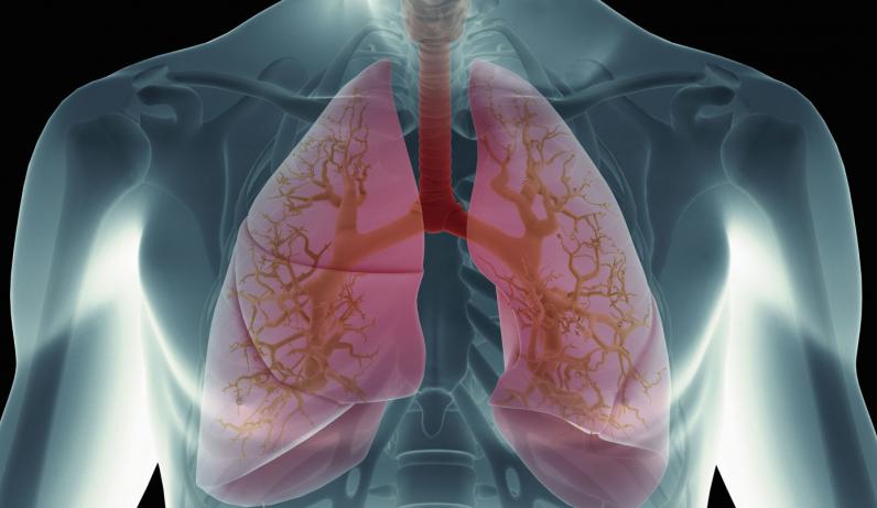 Թոքերի խնդիրների մասին վկայող 6 նշան