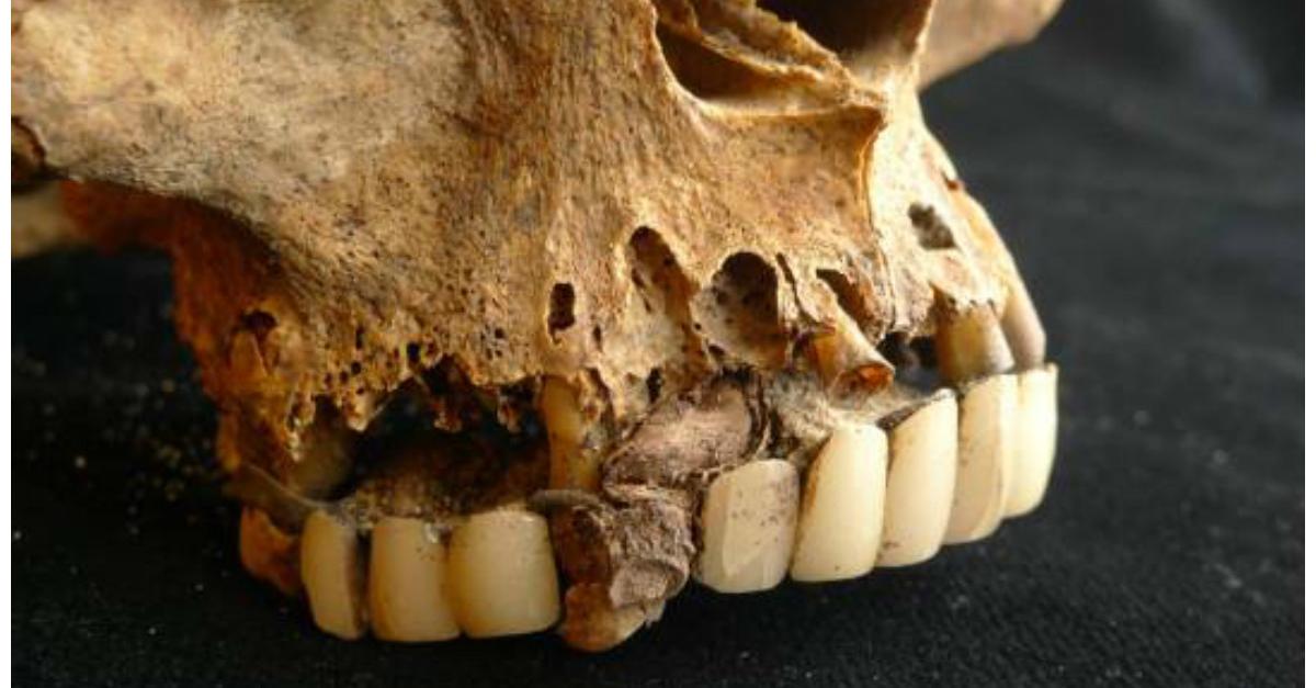 Կարծում եք, որ ատամնաբույժի մոտ գնալը սարսափե՞լի է. ապացույցներ, որ ժամանակակից ատամնաբույժներն ուղղակի հրաշք են. ՖՈՏՈՇԱՐՔ