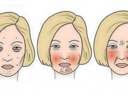 4 մթերք, որոնք փչացնում են Ձեր դեմքը 