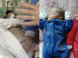 Девушка родила двойню через 123 дня после своей смерти
