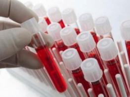 Գիտնականները պարզել են արյան ամենավտանգավոր խումբը