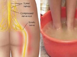 Նստատեղի նյարդի բորբոքմանը հրաժեշտ տվեք ընդամենը 10 րոպեում այս բնական միջոցով