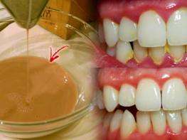 Эффективная домашняя жидкость для полоскания рта, которая удаляет зубной налет всего за 2 минуты