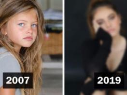 Տիեզերական գեղեցկություն. 17-ամյա Թիլան Բլոնդոյի դեմքն ամենագեղեցիկն է ճանաչվել 2018-ին. ՖՈՏՈՇԱՐՔ